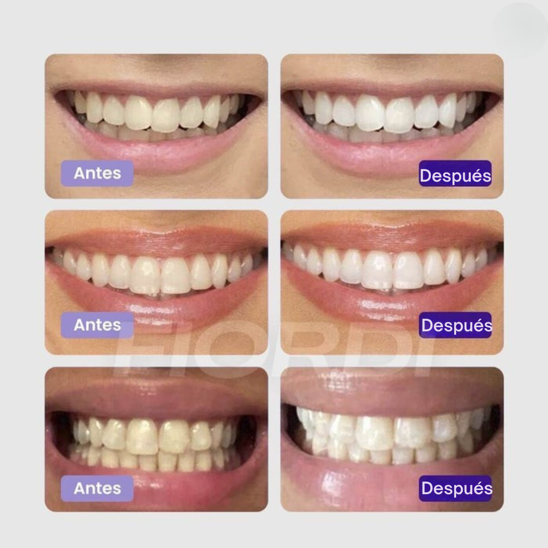 Crema Blanqueadora Hismile - LumiWhite®