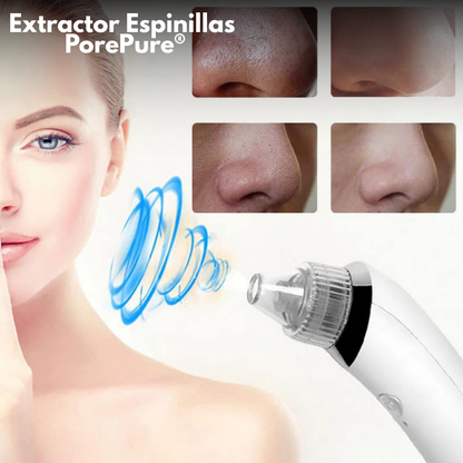 Extractor Espinillas – PorePure®