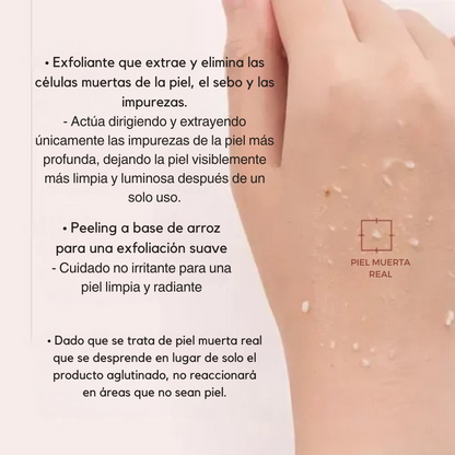Duo Dr RiceSkin® | Elimina puntos negros