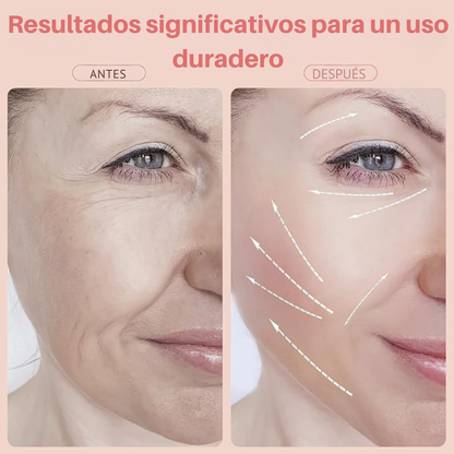 Masajeador Facial Estimulador - LumiSkin®
