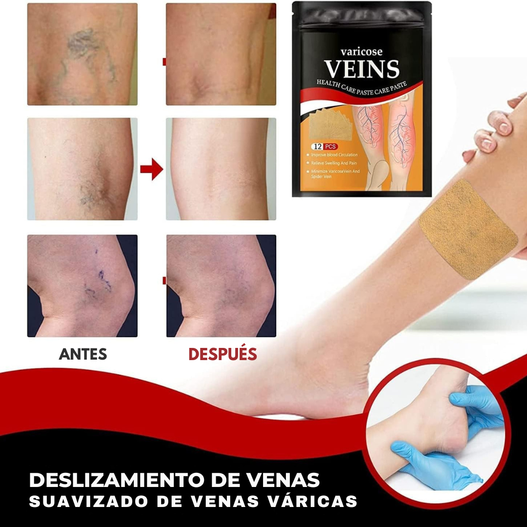 Parche Vena Varice - VenoPatch®